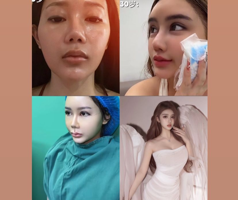 Hasil Oplas BeYoung Forever yang Viral: Natural, Elegan, dan Anti Gagal
